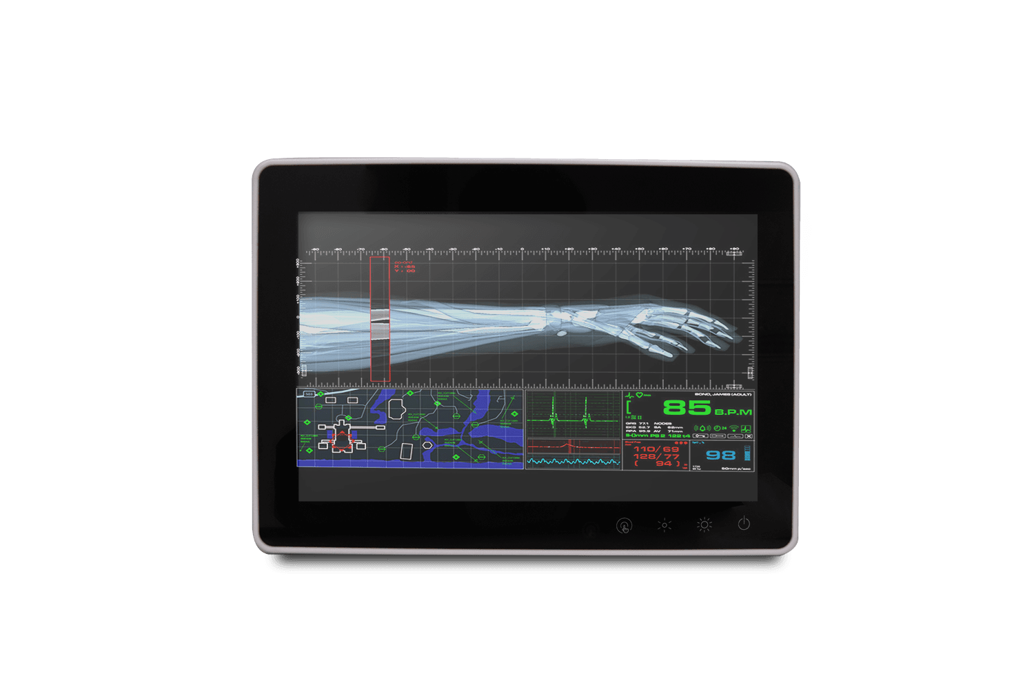 10.1" Fanless Slim Medical All In One Pc