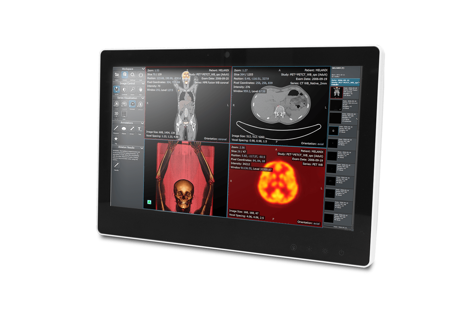 15.6" Fanless Slim Medical All In One Pc