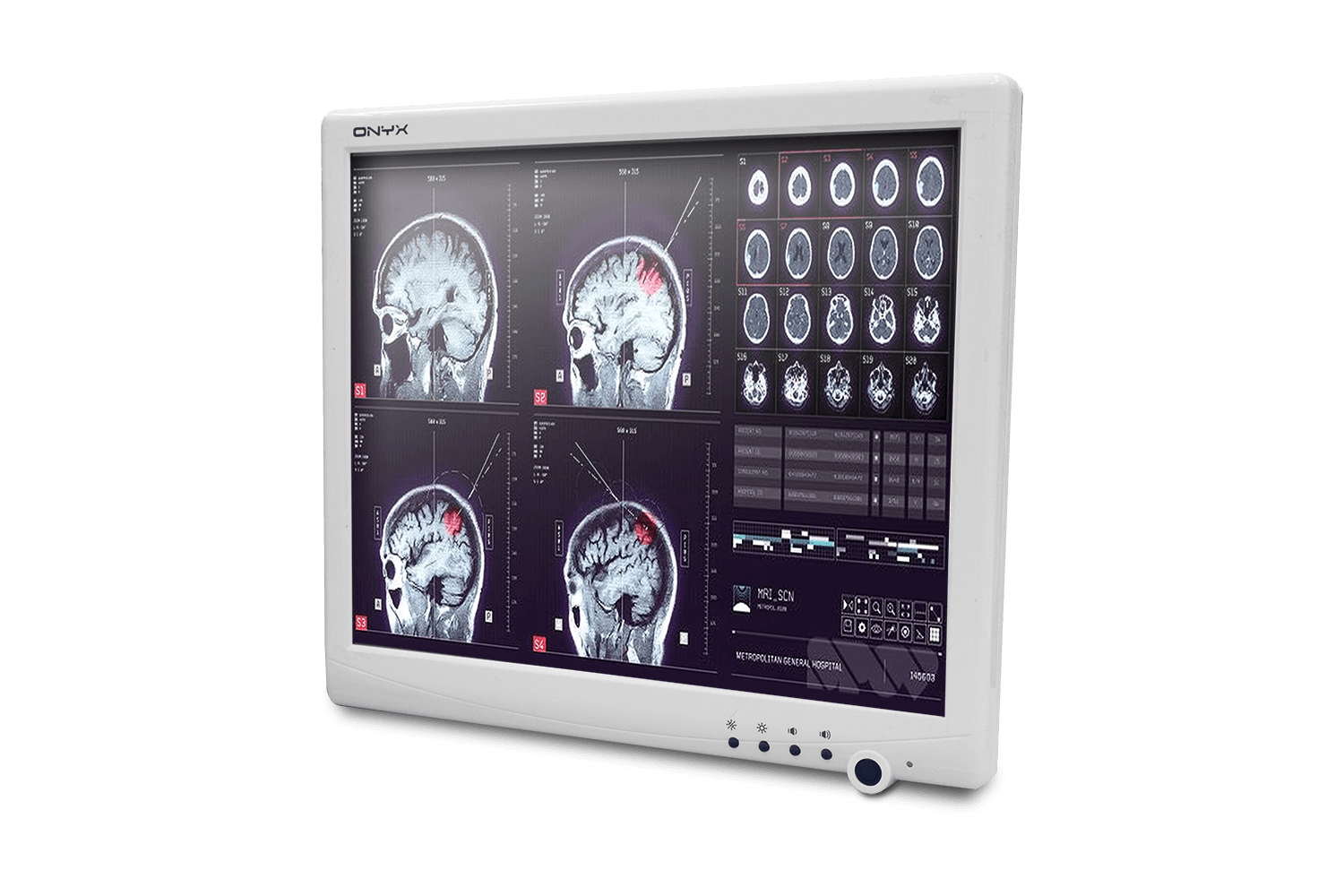 17" Fanless Slim Medical All In One Pc